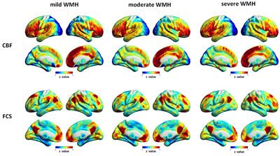 Abnormal Cerebral Blood Flow and Functional Connectivity Strength in Subjects With White Matter Hyperintensities